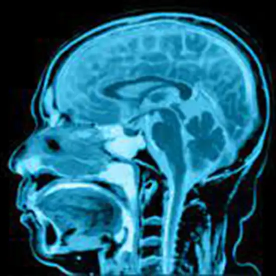 MRI Head Screening